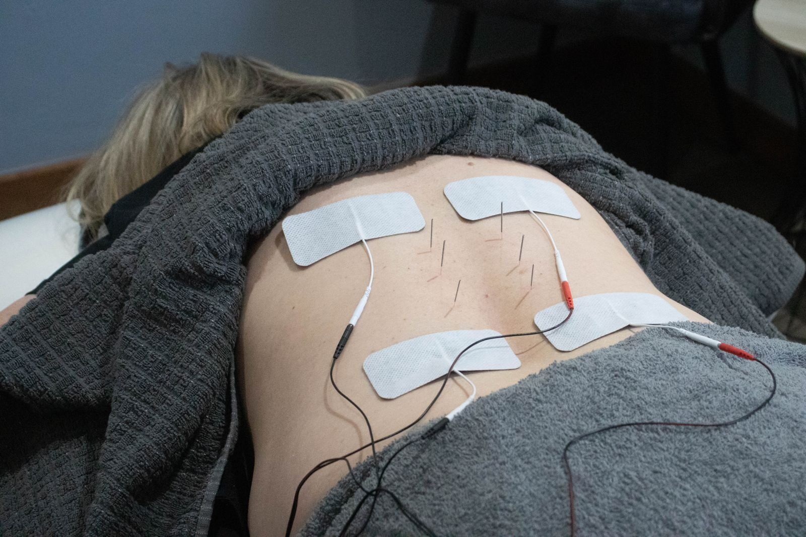 Electrotherapy at Peak Physiotherapy, Mayville, Pretoria